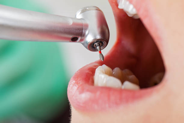 Best Emergency Orthodontic Repairs in Savannah, GA